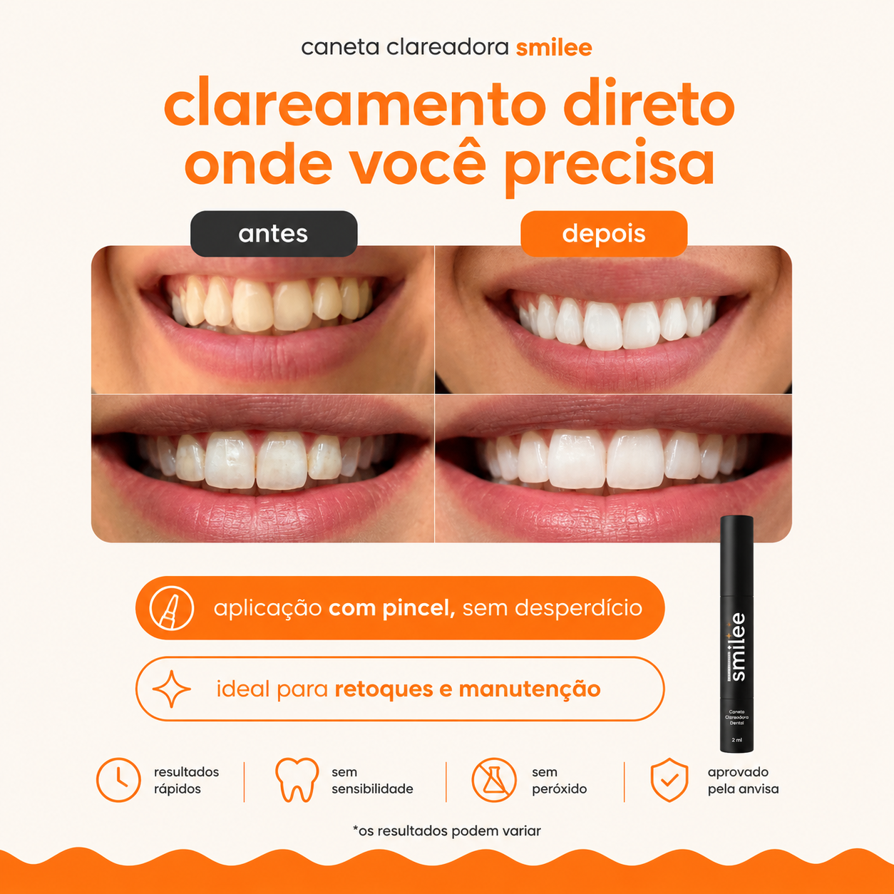 Caneta Clareadora Dental Smilee